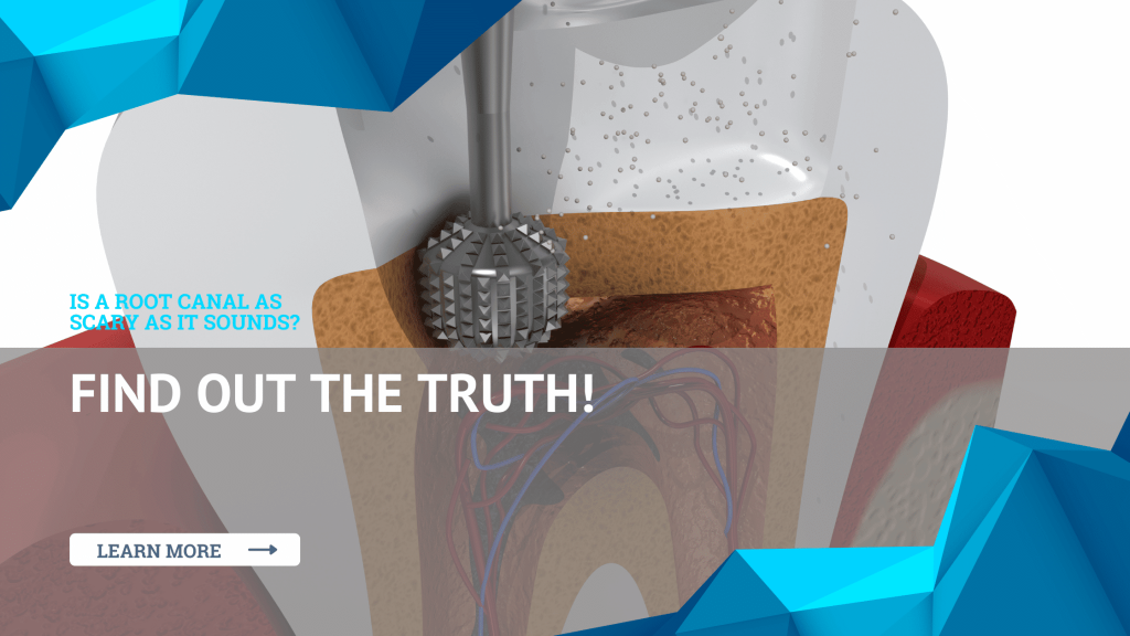 Uncover the Hidden Truths: Explore the Surefire Signs of a Needed Root Canal 1 uncover the hidden truths explore the surefire signs of a needed root canal