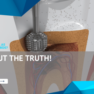 uncover the hidden truths explore the surefire signs of a needed root canal